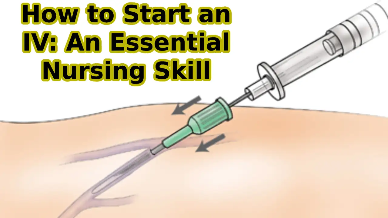 How to Start an IV